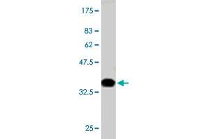 Western Blot detection against Immunogen (36. (PIK3R4 抗体  (AA 1259-1358))