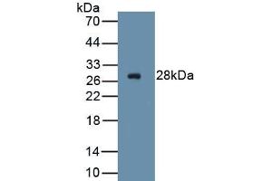 Detection of Recombinant ICAM2, Human using Polyclonal Antibody to Intercellular Adhesion Molecule 2 (ICAM2) (ICAM2 抗体  (AA 34-241))