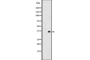 Western blot analysis of OR2A12 expression in CEM cell line lysates ,The lane on the left is treated with the antigen-specific peptide. (OR2A12 抗体  (C-Term))