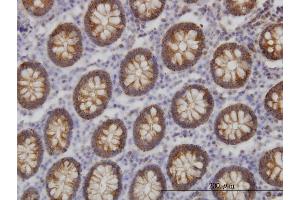 Immunoperoxidase of monoclonal antibody to BAIAP2L1 on formalin-fixed paraffin-embedded human colon.