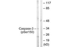 Western blot analysis of extracts from Jurkat cells treated with Etoposide 25uM 60', using Caspase 3 (Phospho-Ser150) Antibody. (Caspase 3 抗体  (pSer150))
