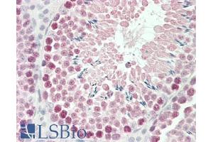 Immunohistochemistry (IHC) image for anti-Roundabout, Axon Guidance Receptor, Homolog 1 (ROBO1) (Internal Region) antibody (ABIN185724)