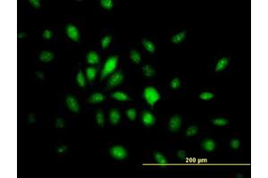 Image no. 4 for anti-High Mobility Group 20B (HMG20B) (AA 1-110) antibody (ABIN599130) (HMG20B 抗体  (AA 1-110))
