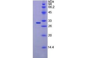 Chymotrypsin C (Caldecrin) (CTRC) protein