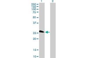 Western Blot analysis of LOC391746 expression in transfected 293T cell line by LOC391746 MaxPab polyclonal antibody. (TAF11L4 抗体  (AA 1-198))