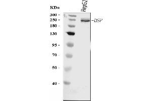 Western blot analysis of Desmoplakin/DSP using anti-Desmoplakin/DSP antibody (ABIN7602296).