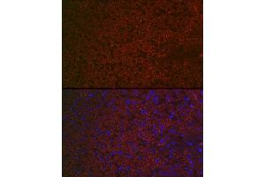 Immunofluorescence analysis of rat liver using R Rabbit pAb (ABIN6131585, ABIN6146704, ABIN6146705 and ABIN6222716) at dilution of 1:100 (40x lens).