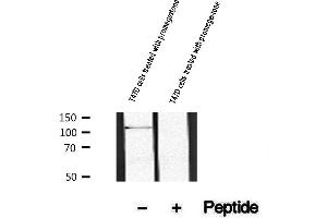 Western blot analysis of extracts of T47D cells treated with promegestone, using Phospho-Progesterone Receptor (Ser190) Antibody.