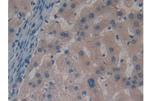 Immunohistochemistry (IHC) image for anti-Synuclein, gamma (Breast Cancer-Specific Protein 1) (SNCG) (AA 1-121) antibody (ABIN7429343)