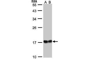 WB Image Sample(30 ug whole cell lysate) A:293T whole cell lysate B:A431, 12% SDS PAGE antibody diluted at 1:1000 (HSPB8 抗体  (C-Term))