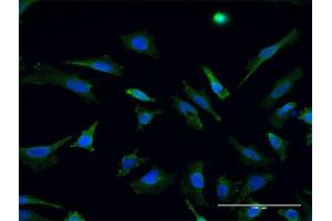 Immunofluorescence of monoclonal antibody to RHOT1 on HeLa cell. (RHOT1 抗体  (AA 483-580))