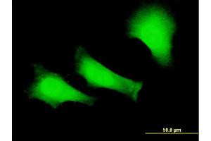 Immunofluorescence of monoclonal antibody to FANCC on HeLa cell. (FANCC 抗体  (AA 1-100))