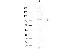 Western blot analysis of lysates from EC304 cells, using Scavenger Receptor BII Mouse Monoclonal Antibody at 1/1000 dilution.