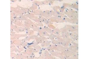 Used in DAB staining on fromalin fixed paraffin- embedded Kidney tissue (LAMC2 抗体  (AA 1003-1192))