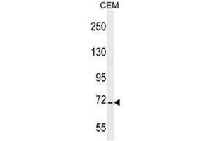 STIM1 Antibody (C-term) western blot analysis in CEM cell line lysates (35µg/lane). (STIM1 抗体  (C-Term))