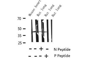 Western blot analysis of Phospho-MARCKS (Ser158) Antibody expression in mouse heart and rat lung tissues lysates. (MARCKS 抗体  (pSer159))