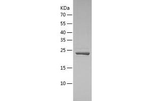 USP8 Protein (AA 886-1096) (His tag)