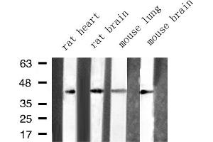 Western blot analysis of ARFIP1 expression in various lysates (ARFIP1 抗体  (Internal Region))