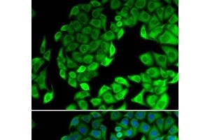 Immunofluorescence analysis of MCF-7 cells using RPL14 Polyclonal Antibody (RPL14 抗体)