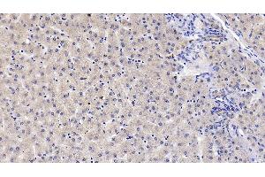 Immunohistochemistry (IHC) image for anti-Vitamin D-Binding Protein (GC) (AA 209-401) antibody (ABIN7426364)