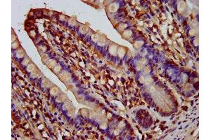 IHC image of ABIN7144503 diluted at 1:200 and staining in paraffin-embedded human small intestine tissue performed on a Leica BondTM system. (Aquaporin 1 抗体  (AA 209-301))