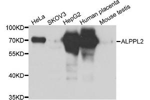 Western blot analysis of extracts of various cell lines, using ALPPL2 antibody (ABIN5975268) at 1/1000 dilution. (ALPPL2 抗体)