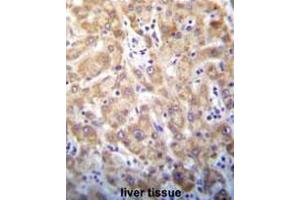 Immunohistochemistry in Formalin-fixed, Paraffin embedded human liver tissue stained with Syntaxin 2 / STX2 Antibody (Center) followed by peroxidase conjugation of the secondary antibody and DAB staining.