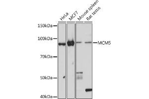 Western blot analysis of extracts of various cell lines, using MCM5 Rabbit mAb (ABIN7268543) at 1:1000 dilution. (MCM5 抗体)