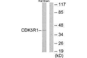 Western blot analysis of extracts from rat brain cells, using CDK5R1 antibody. (CDK5R1 抗体  (N-Term))