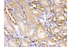 IHC testing of FFPE mouse kidney with ACTN4 antibody at 1ug/ml.