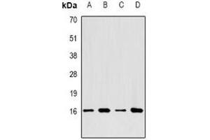 Western blot analysis of LC3A expression in SHSY5Y (A), HepG2 (B), BT474 (C), mouse brain (D) whole cell lysates. (MAP1LC3A 抗体)