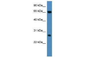 WB Suggested Anti-KBTBD8 Antibody Titration: 0. (KBTBD8 抗体  (N-Term))