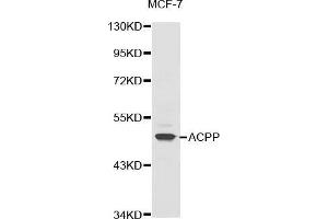 Western blot analysis of extracts of MCF-7 cell line, using ACPP antibody. (ACPP 抗体  (AA 40-300))