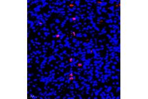 Immunofluorescence of paraffin embedded mouse nephritis using CD177 (ABIN7073372) at dilution of 1:500 (400x lens) (CD177 抗体)