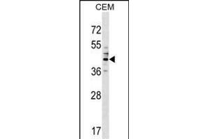 CEAC Antibody (Center) (ABIN1537994 and ABIN2849399) western blot analysis in CEM cell line lysates (35 μg/lane). (CEACAM6 抗体  (AA 188-214))