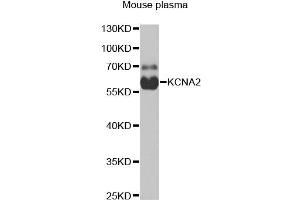 Western blot analysis of extracts of mouse plasma, using KCNA2 antibody (ABIN1980311) at 1:1000 dilution. (KCNA2 抗体)