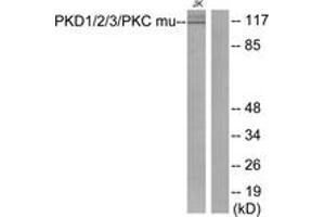 Western blot analysis of extracts from Jurkat cells, using PKD1/2/3/PKC mu (Ab-744/748) Antibody. (PKD1/2/3/PKC mu (AA 706-755) 抗体)