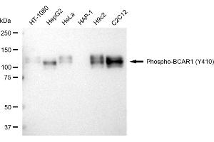 Western blotting analysis using Phospho-BCAR1 (Y410) antibody (ABIN7797792). (Recombinant BCAR1 抗体  (pTyr410))