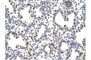 FLJ12529 antibody was used for immunohistochemistry at a concentration of 4-8 ug/ml to stain Alveolar cells (arrows) in Human Lung. (CPSF7 抗体  (C-Term))