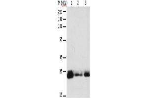 Western Blotting (WB) image for anti-RAB6A, Member RAS Oncogene Family (RAB6A) antibody (ABIN2425552) (RAB6A 抗体)