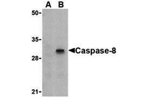 Western Blotting (WB) image for anti-Caspase 8 (CASP8) (C-Term) antibody (ABIN1030320) (Caspase 8 抗体  (C-Term))