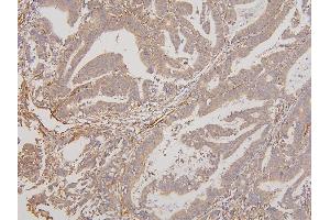 IHC analysis of RAB3GAP2 using anti-RAB3GAP2 antibody (ABIN6719633). (RAB3GAP2 抗体  (AA 1-115))