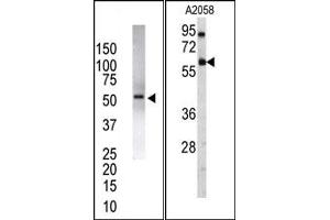Image no. 2 for anti-Ubiquitin Specific Peptidase 14 (USP14) (N-Term) antibody (ABIN357546) (USP14 抗体  (N-Term))