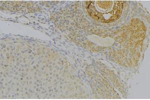 ABIN6277291 at 1/100 staining Human uterus tissue by IHC-P. (NRP2 抗体  (N-Term))