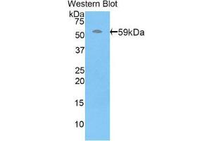 Western Blotting (WB) image for anti-Perforin 1 (Pore Forming Protein) (PRF1) (AA 32-316) antibody (ABIN1860311) (Perforin 1 抗体  (AA 32-316))