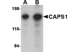 Western Blotting (WB) image for anti-Ca++-Dependent Secretion Activator (CADPS) (N-Term) antibody (ABIN1031290) (CADPS 抗体  (N-Term))
