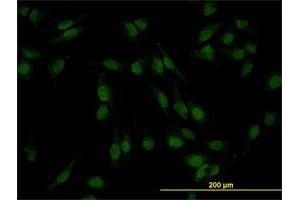 Immunofluorescence of monoclonal antibody to SMAD4 on HeLa cell.
