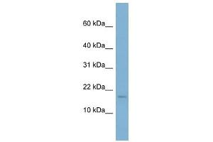 RPS13 antibody used at 1 ug/ml to detect target protein. (RPS13 抗体  (N-Term))