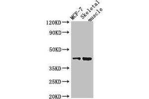 Western Blot Positive WB detected in: MCF-7 whole cell lysate, Mouse skeletal muscle tissue All lanes: USP18 antibody at 2 μg/mL Secondary Goat polyclonal to rabbit IgG at 1/50000 dilution Predicted band size: 44, 42 kDa Observed band size: 44 kDa (USP18 抗体  (C-Term))