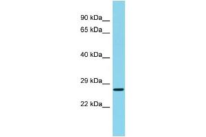 Host: Rabbit Target Name: C22orf13 Sample Type: Fetal Liver lysates Antibody Dilution: 1. (C22orf13 抗体  (C-Term))